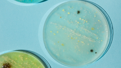 Boite de patri avec des colonies bacteriennes ou levures