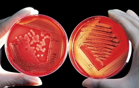Bacterial and fungal flash identification ⏱️